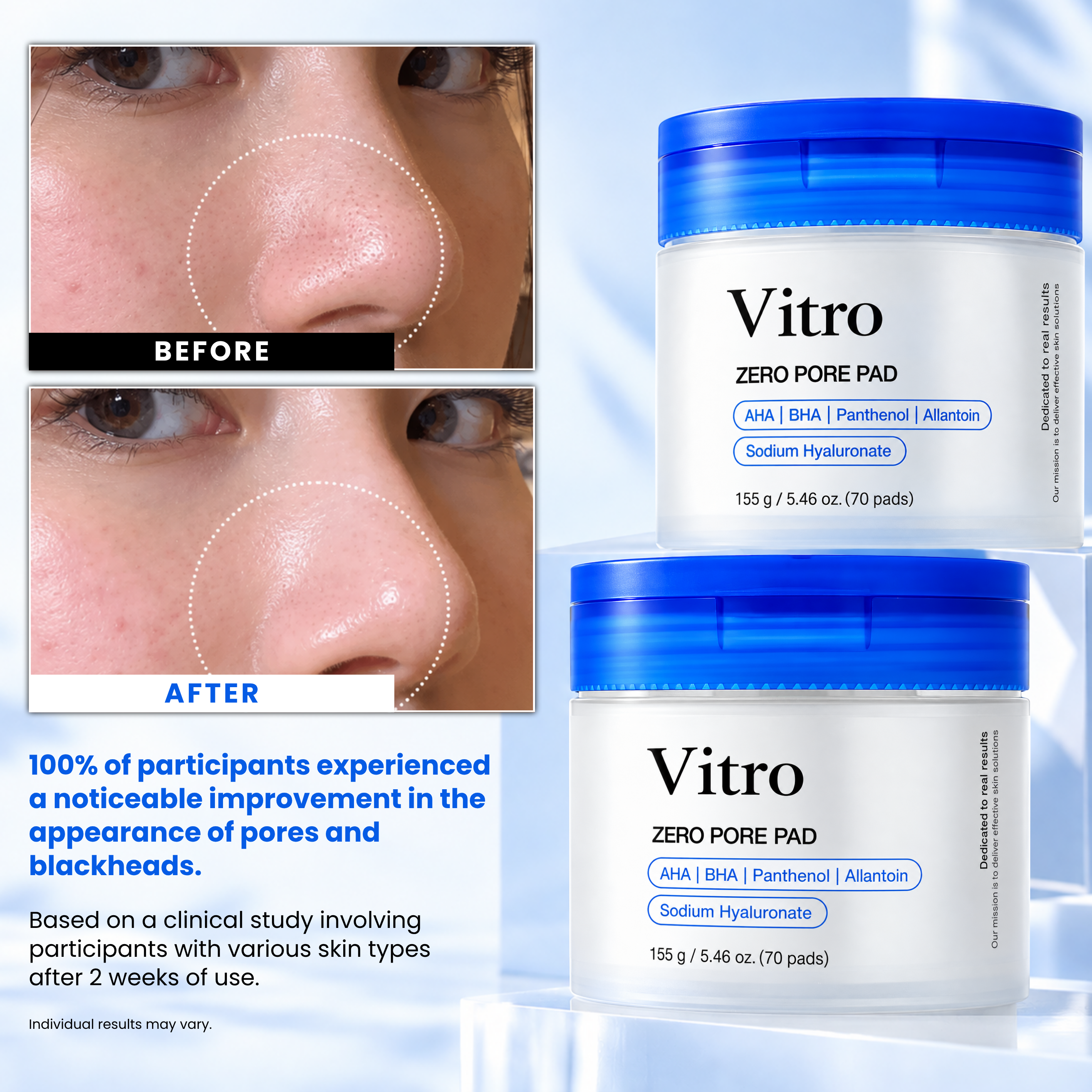 Zero Pore Pads