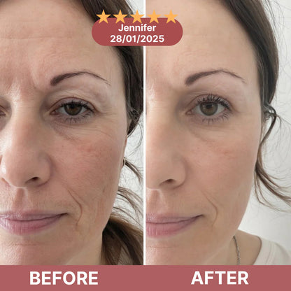 Vitro - Calcium Eye Patch