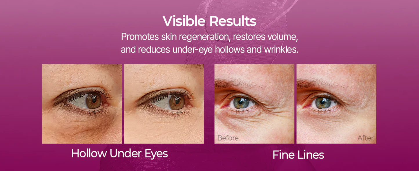 Vitro - Calcium Eye Patch
