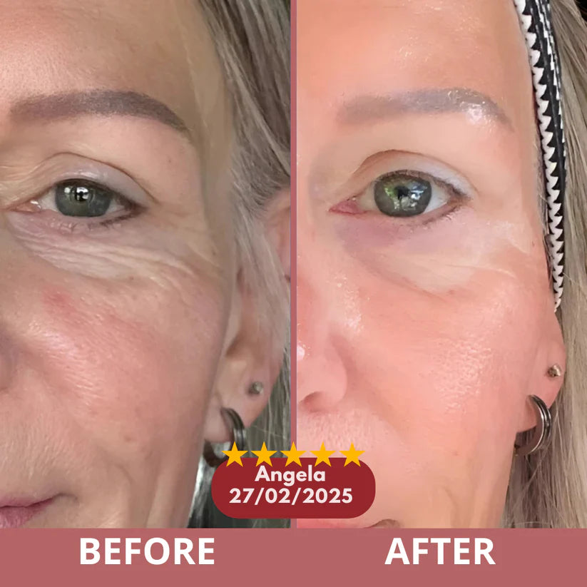 Vitro - Calcium Eye Patch