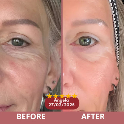 Vitro - Calcium Eye Patch